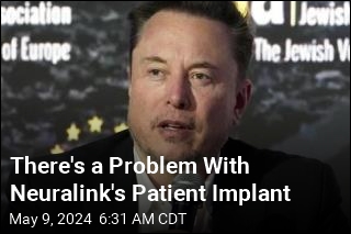 There&#39;s a Problem With Neuralink&#39;s Patient Implant