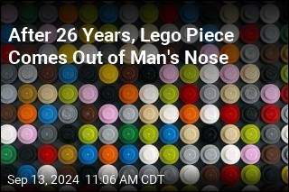 Guy Had Lego Stuck Up His Nose for 26 Years