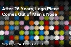 Guy Had Lego Stuck Up His Nose for 26 Years