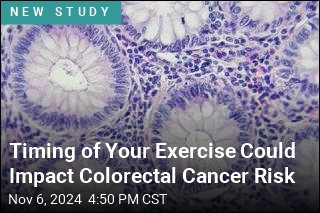 Timing of Your Exercise Could Impact Colorectal Cancer Risk