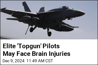 Elite &#39;Topgun&#39; Pilots May Face Brain Injuries