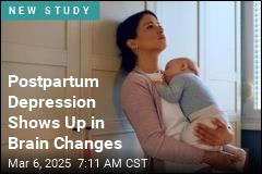 Postpartum Depression May Be Visible in the Brain