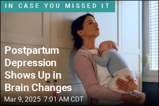 Postpartum Depression May Be Visible in the Brain