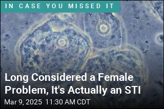 Long Portrayed as a Female Problem, It&#39;s Actually an STI