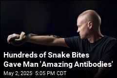 His Hundreds of Snake Bites Could Help Humanity