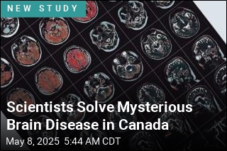 There Is No Mysterious Brain Disease in Canada