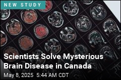 There Is No Mysterious Brain Disease in Canada