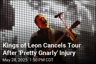 Kings of Leon Cancels Tour After &#39;Pretty Gnarly&#39; Injury