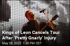 Kings of Leon Cancels Tour After &#39;Pretty Gnarly&#39; Injury