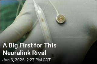 Neuralink Competitor Tests Brain Implant in First Patient