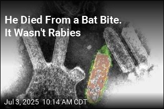 He Died From a Bat Bite. It Wasn&#39;t Rabies