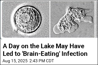 Waterskiing May Have Led to Rare Brain-Eating Infection