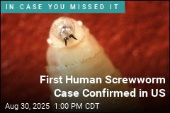 First Human Screwworm Case Confirmed in US