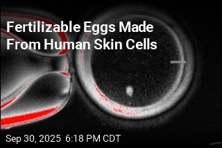 Fertilizable Eggs Made From Human Skin Cells
