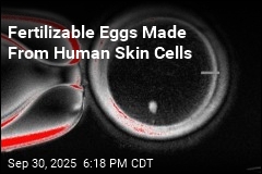 Fertilizable Eggs Made From Human Skin Cells