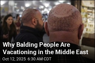 Why Balding People Are Vacationing in the Middle East