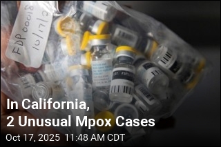 California Sees 2 Unusual Mpox Cases