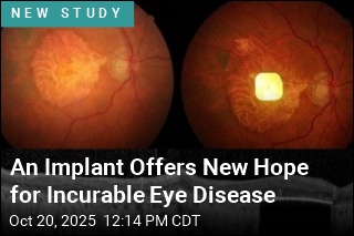 Bionic Retina Lets Blind Patients Read Again