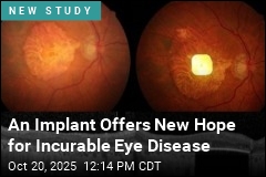 Bionic Retina Lets Blind Patients Read Again