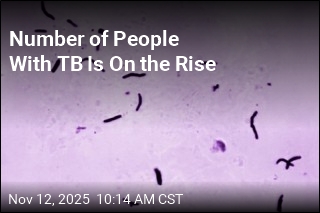 Number of People With TB Is On the Rise
