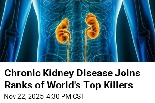 Chronic Kidney Disease Now a Top 10 Global Killer