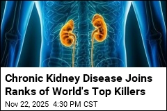 Chronic Kidney Disease Now a Top 10 Global Killer