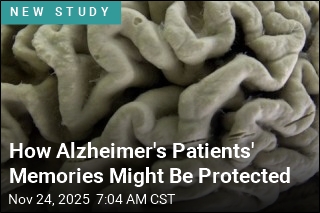 How Alzheimer&#39;s Patients&#39; Memories Might Be Protected