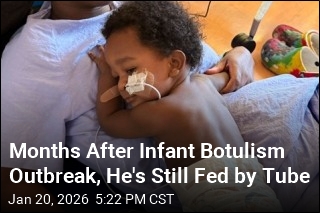 Months After Infant Botulism Outbreak, He's Still Fed by Tube