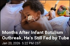Months After Infant Botulism Outbreak, He's Still Fed by Tube