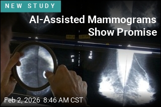 AI Breast Screening Shows Promise in Trial