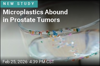 Microplastics Abound in Prostate Tumors