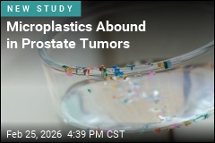 Microplastics Abound in Prostate Tumors