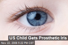 US Child Gets Prosthetic Iris