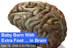 Baby Born With Extra Foot ... in Brain