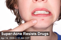 Super-Acne Resists Drugs