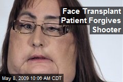 Face Transplant Patient Forgives Shooter