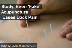Study: Even 'Fake' Acupuncture Eases Back Pain