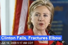 Clinton Falls, Fractures Elbow