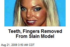 Teeth, Fingers Removed From Slain Model
