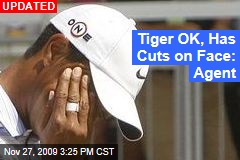 Tiger OK, Has Cuts on Face: Agent