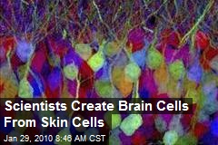 Scientists Create Brain Cells From Skin Cells