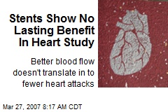 Stents Show No Lasting Benefit In Heart Study