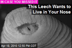 This Leech Wants to Live in Your Nose