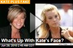 What's Up With Kate's Face?