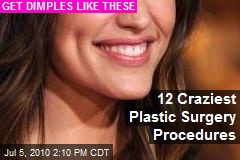 12 Craziest Plastic Surgery Procedures